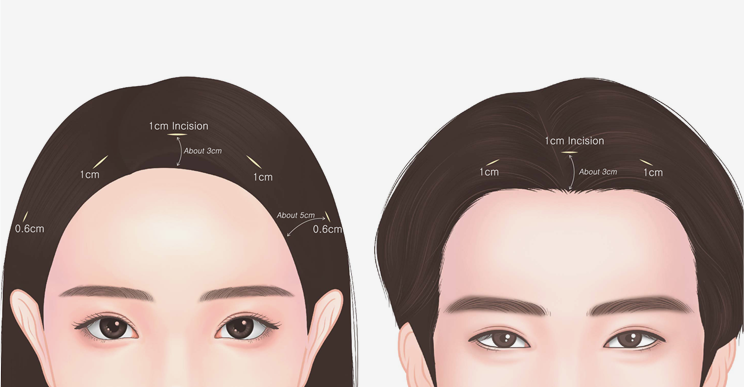 Other K-Art’s world unique surgical