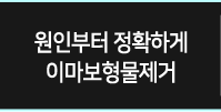 원인부터 정확하게 이마보형물제거